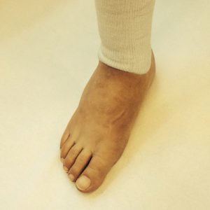 piede03